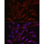 Immunofluorescence - Anti-TIMP2 Antibody (A13504) - Antibodies.com