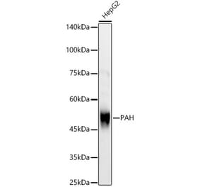 Western Blot - Anti-PAH Antibody (A13505) - Antibodies.com