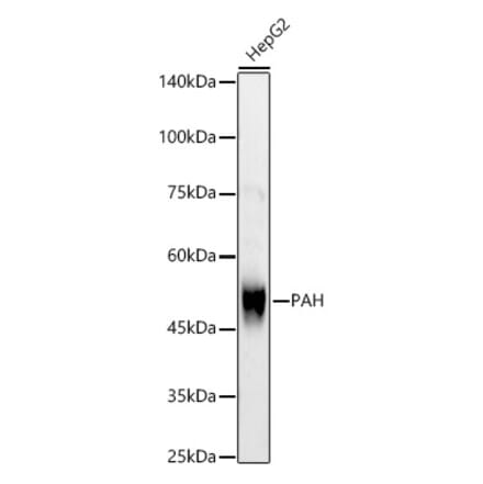 Western Blot - Anti-PAH Antibody (A13505) - Antibodies.com
