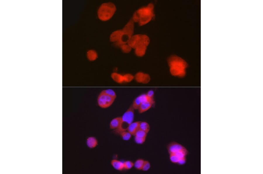 Immunofluorescence - Anti-PAH Antibody (A13505) - Antibodies.com