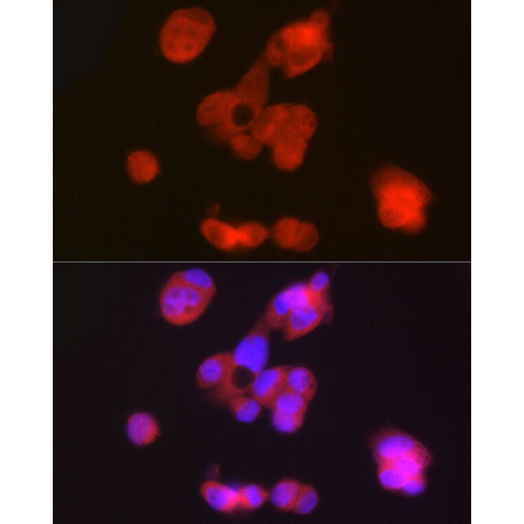 Immunofluorescence - Anti-PAH Antibody (A13505) - Antibodies.com