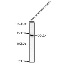 Western Blot - Anti-Collagen II Antibody (A13506) - Antibodies.com