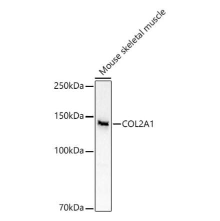Western Blot - Anti-Collagen II Antibody (A13506) - Antibodies.com