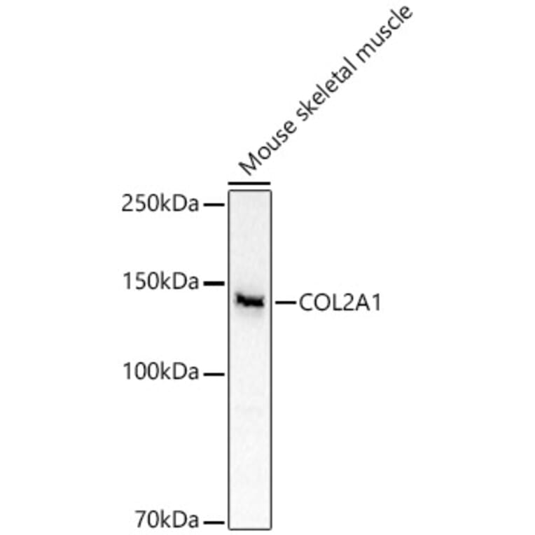 Western Blot - Anti-Collagen II Antibody (A13506) - Antibodies.com