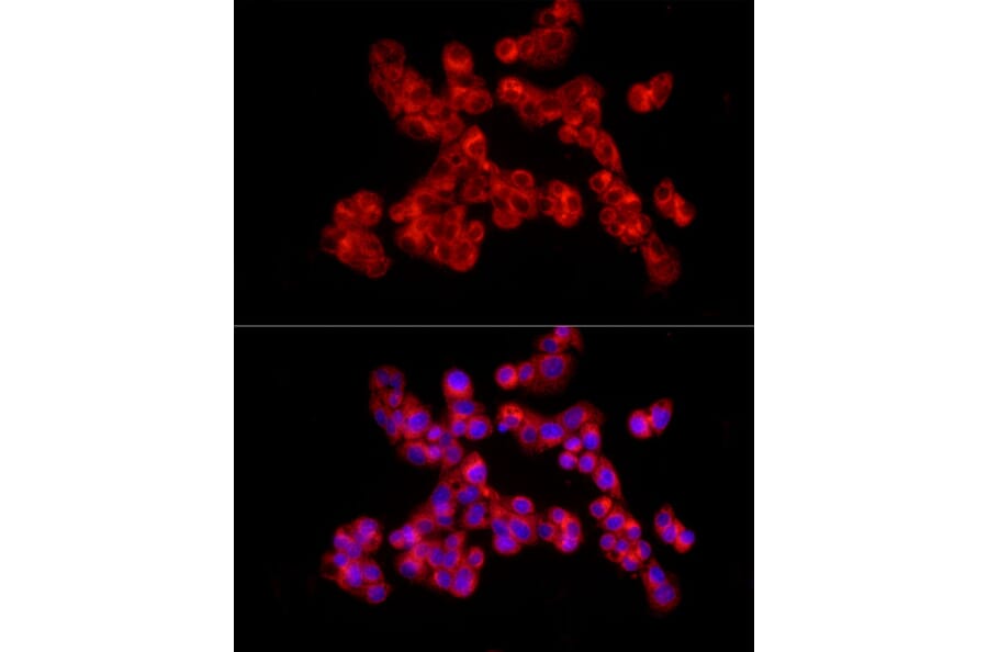 Immunofluorescence - Anti-Collagen II Antibody (A13506) - Antibodies.com
