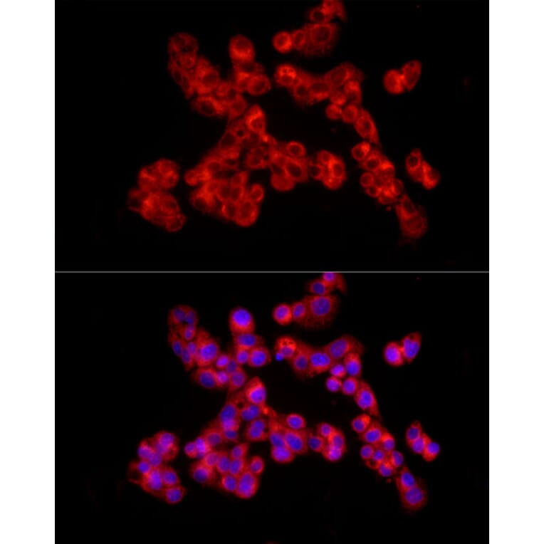 Immunofluorescence - Anti-Collagen II Antibody (A13506) - Antibodies.com