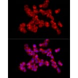 Immunofluorescence - Anti-Collagen II Antibody (A13506) - Antibodies.com