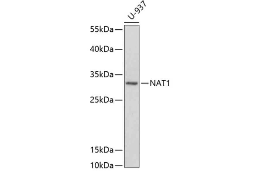 Western Blot - Anti-NAT1 Antibody (A1563) - Antibodies.com