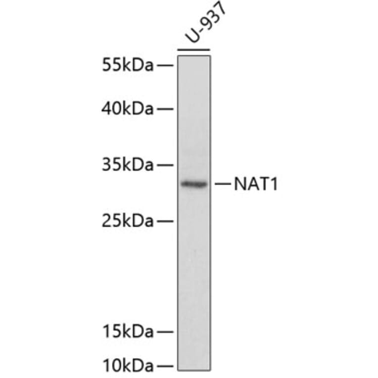 Western Blot - Anti-NAT1 Antibody (A1563) - Antibodies.com