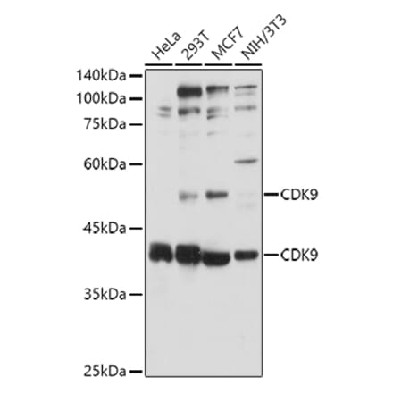 Western Blot - Anti-Cdk9 Antibody (A13508) - Antibodies.com