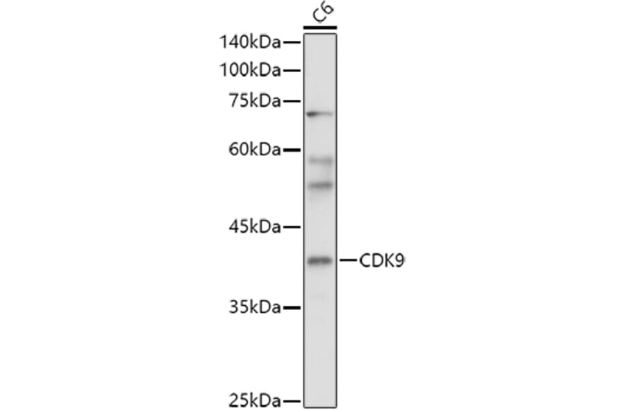 Western Blot - Anti-Cdk9 Antibody (A13508) - Antibodies.com