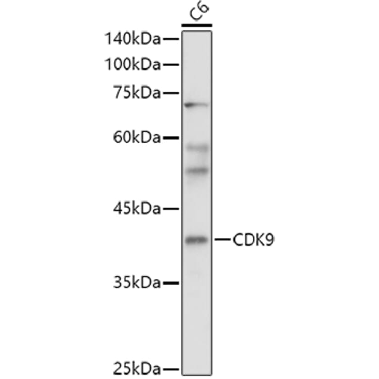 Western Blot - Anti-Cdk9 Antibody (A13508) - Antibodies.com