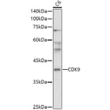 Western Blot - Anti-Cdk9 Antibody (A13508) - Antibodies.com