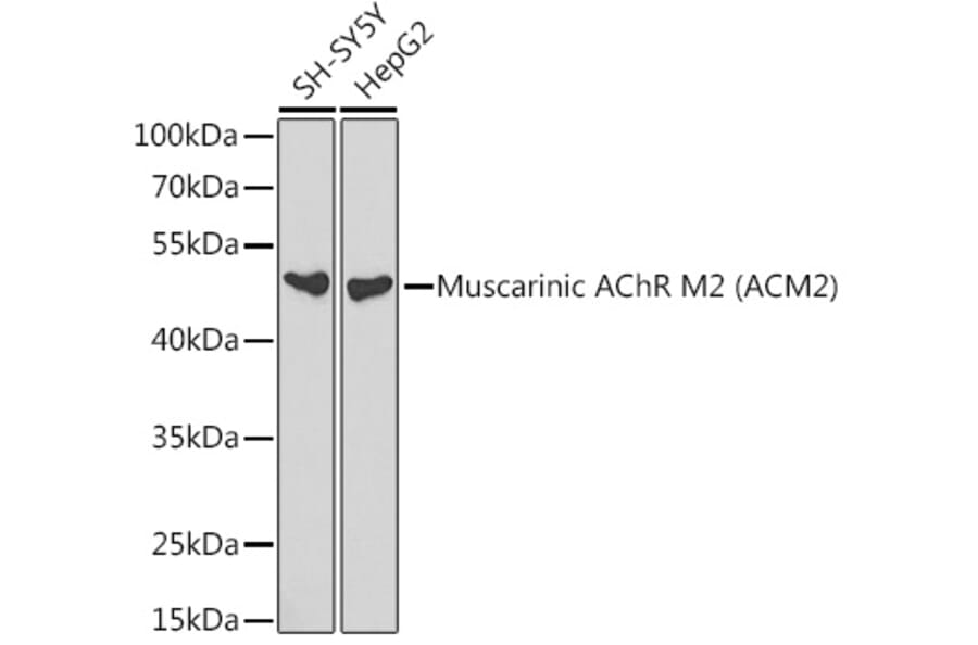 Western Blot - Anti-Muscarinic Acetylcholine Receptor 2/CM2 Antibody (A13510) - Antibodies.com