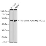 Western Blot - Anti-Muscarinic Acetylcholine Receptor 2/CM2 Antibody (A13510) - Antibodies.com