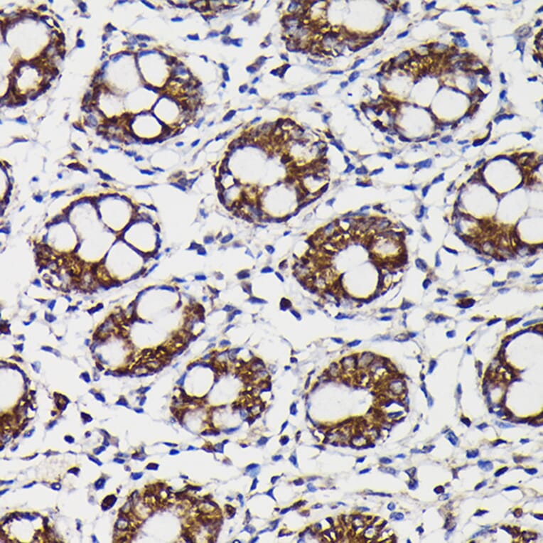 Immunohistochemistry - Anti-Monoamine Oxidase B/MAOB Antibody (A13511) - Antibodies.com