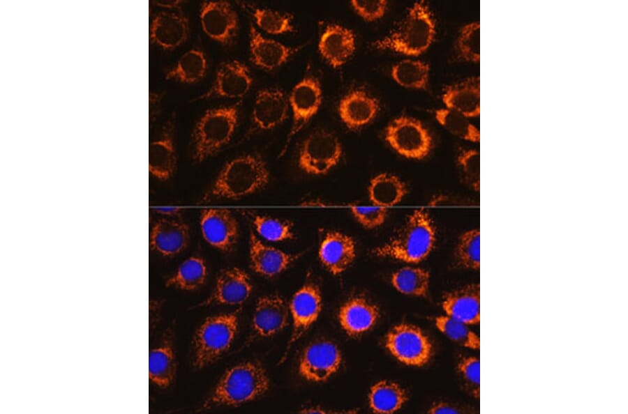 Immunofluorescence - Anti-Monoamine Oxidase B/MAOB Antibody (A13511) - Antibodies.com