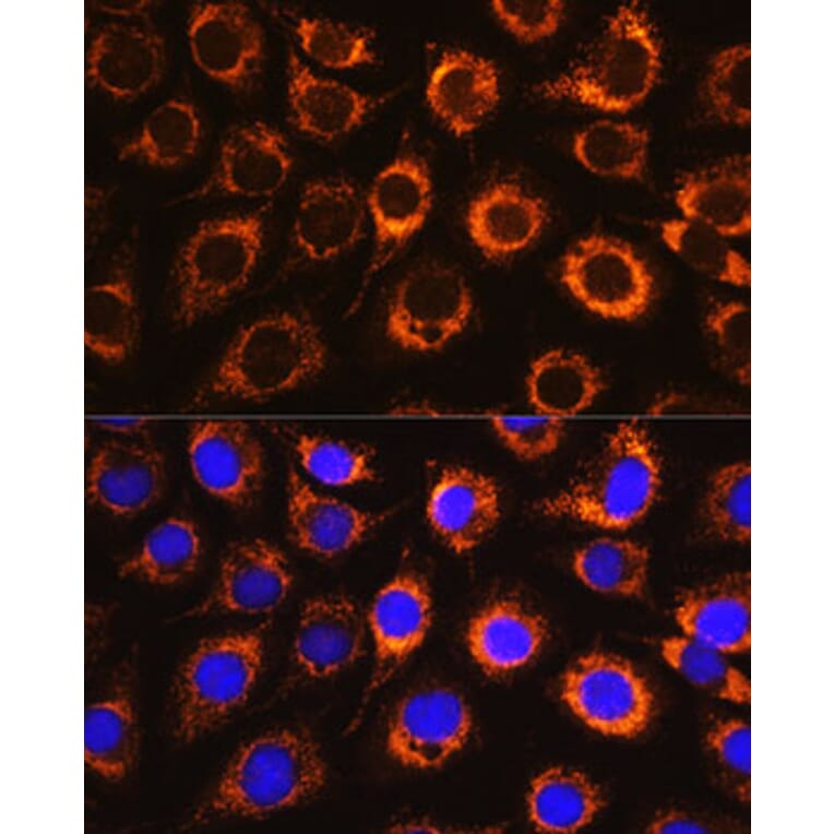 Immunofluorescence - Anti-Monoamine Oxidase B/MAOB Antibody (A13511) - Antibodies.com