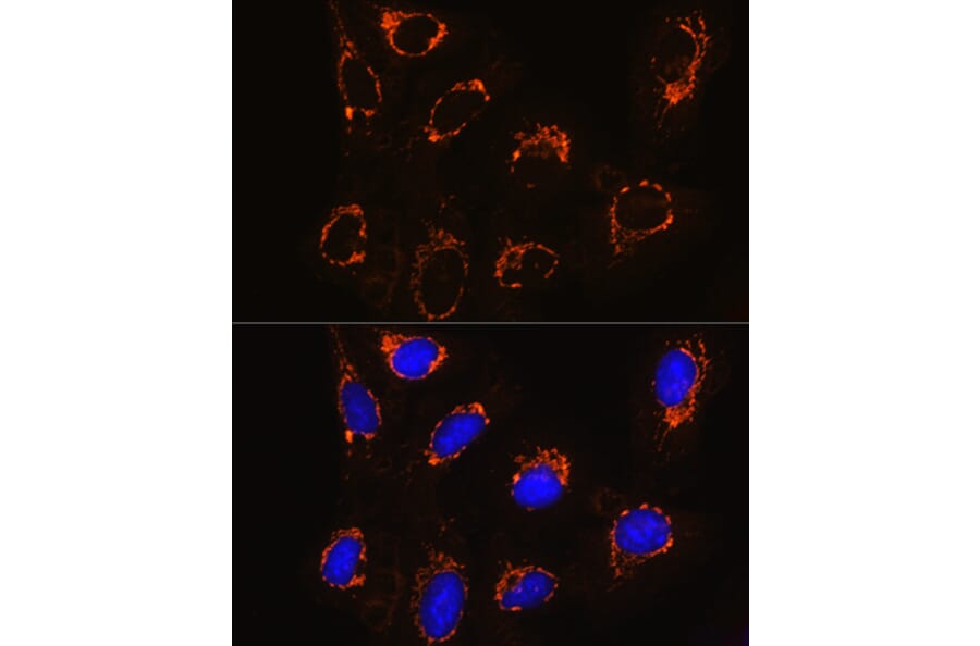 Immunofluorescence - Anti-Monoamine Oxidase B/MAOB Antibody (A13511) - Antibodies.com