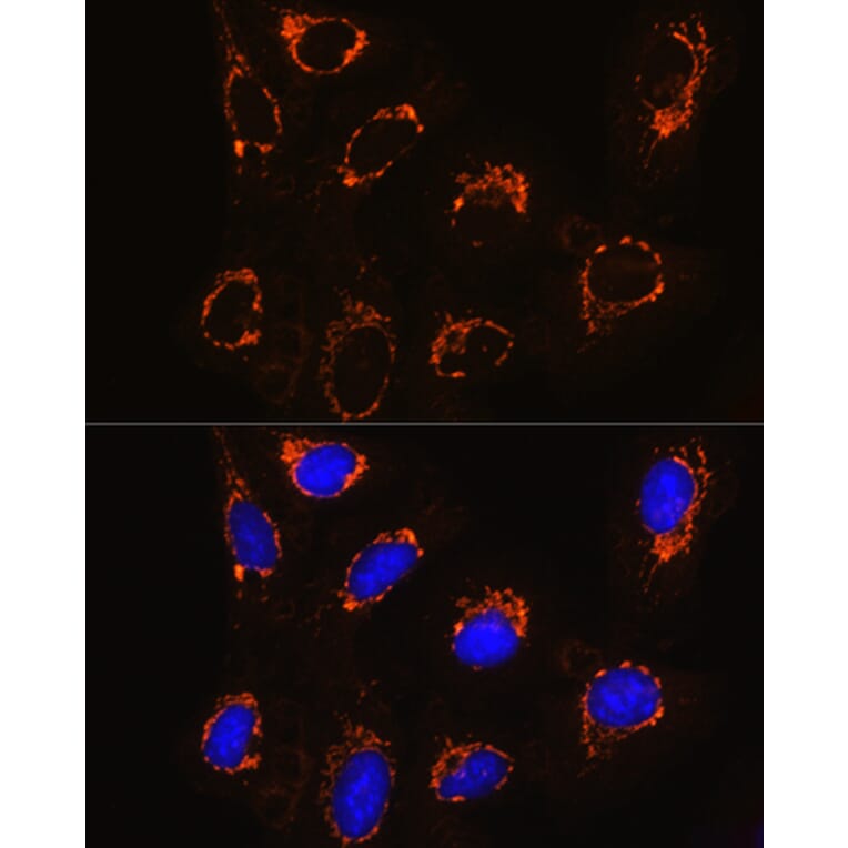 Immunofluorescence - Anti-Monoamine Oxidase B/MAOB Antibody (A13511) - Antibodies.com