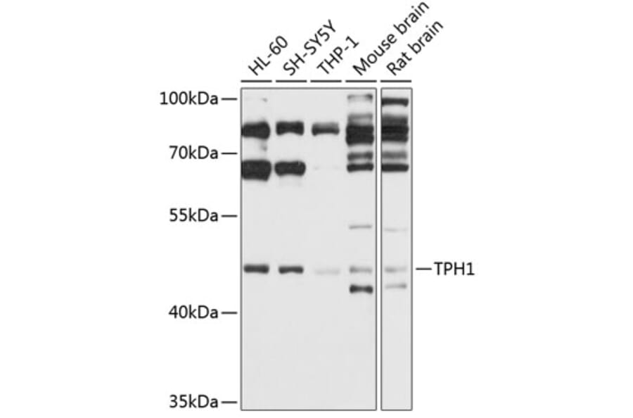 Western Blot - Anti-Tryptophan Hydroxylase/TPH Antibody (A13512) - Antibodies.com