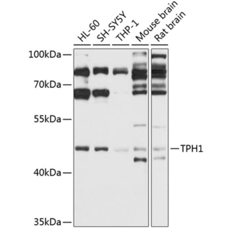 Western Blot - Anti-Tryptophan Hydroxylase/TPH Antibody (A13512) - Antibodies.com