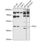 Western Blot - Anti-Tryptophan Hydroxylase/TPH Antibody (A13512) - Antibodies.com