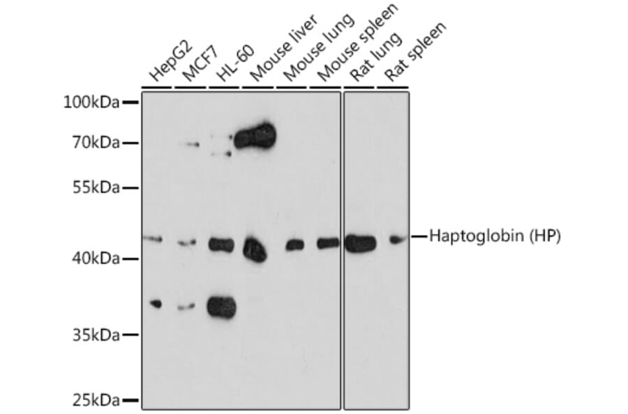 Western Blot - Anti-Haptoglobin Antibody (A13513) - Antibodies.com