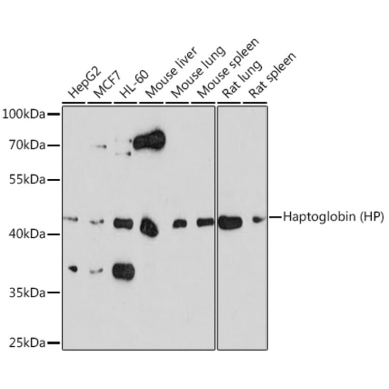 Western Blot - Anti-Haptoglobin Antibody (A13513) - Antibodies.com