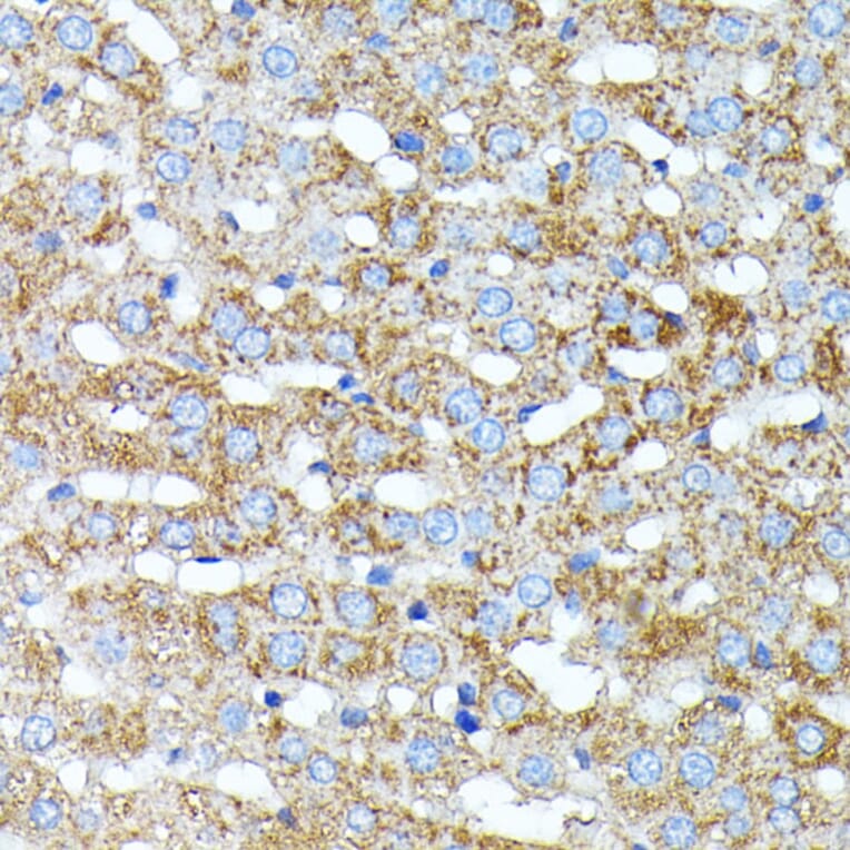 Immunohistochemistry - Anti-Haptoglobin Antibody (A13513) - Antibodies.com