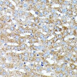 Immunohistochemistry - Anti-Haptoglobin Antibody (A13513) - Antibodies.com