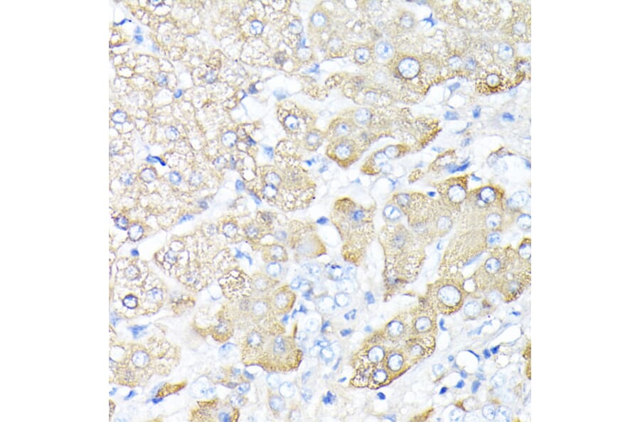 Immunohistochemistry - Anti-Haptoglobin Antibody (A13513) - Antibodies.com