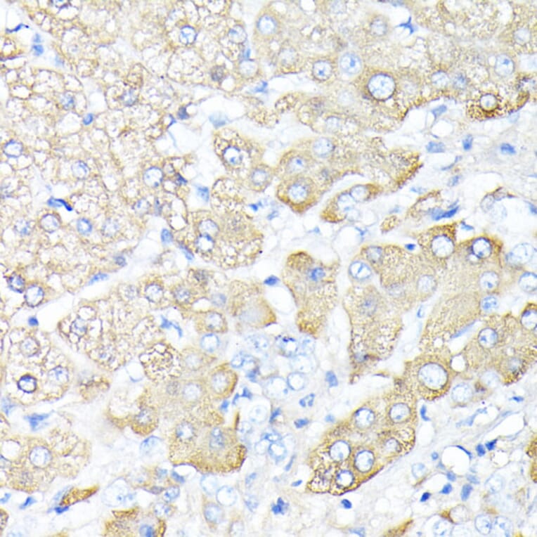Immunohistochemistry - Anti-Haptoglobin Antibody (A13513) - Antibodies.com