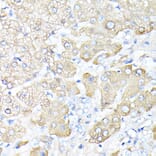 Immunohistochemistry - Anti-Haptoglobin Antibody (A13513) - Antibodies.com