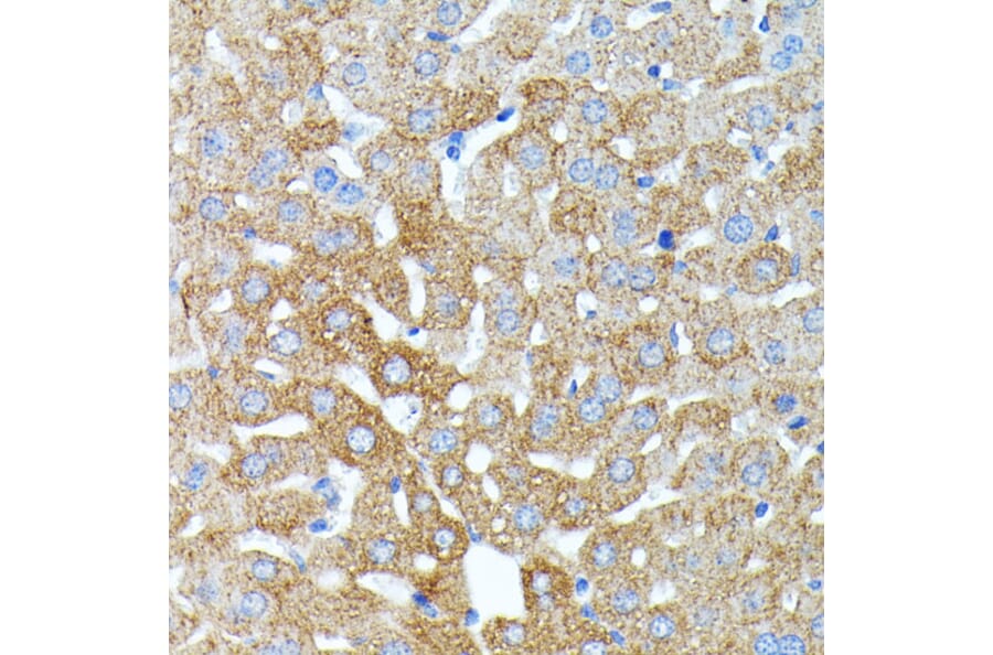 Immunohistochemistry - Anti-Haptoglobin Antibody (A13513) - Antibodies.com