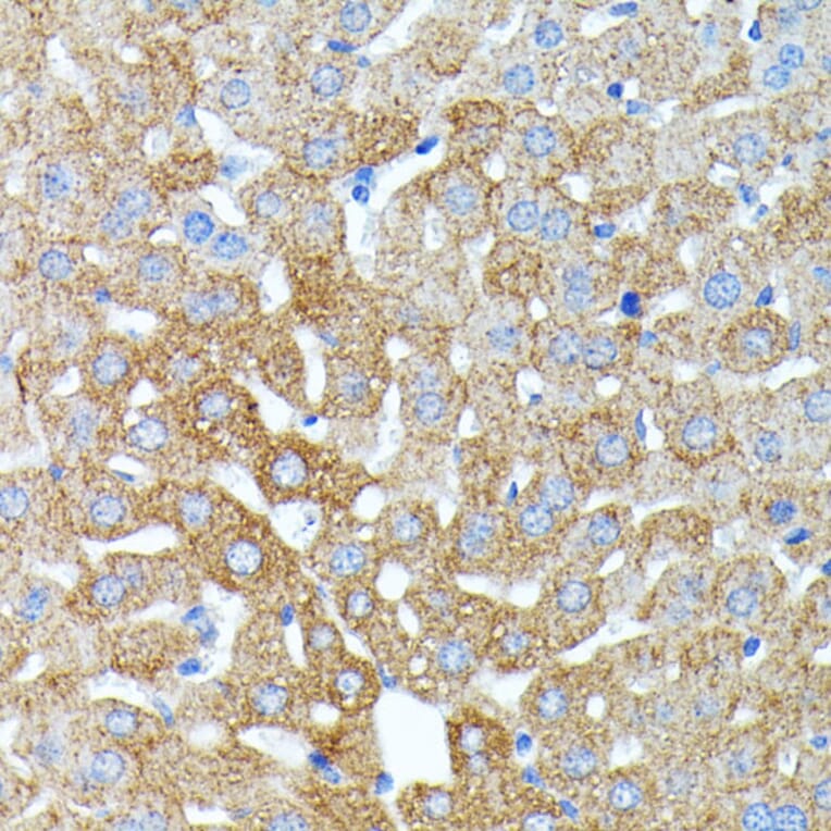 Immunohistochemistry - Anti-Haptoglobin Antibody (A13513) - Antibodies.com