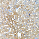 Immunohistochemistry - Anti-Haptoglobin Antibody (A13513) - Antibodies.com