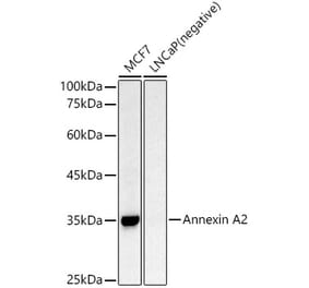 Western Blot - Anti-Annexin A2 Antibody (A13514) - Antibodies.com