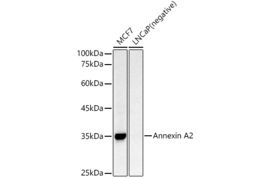 Western Blot - Anti-Annexin A2 Antibody (A13514) - Antibodies.com