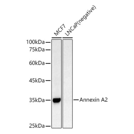 Western Blot - Anti-Annexin A2 Antibody (A13514) - Antibodies.com