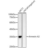 Western Blot - Anti-Annexin A2 Antibody (A13514) - Antibodies.com