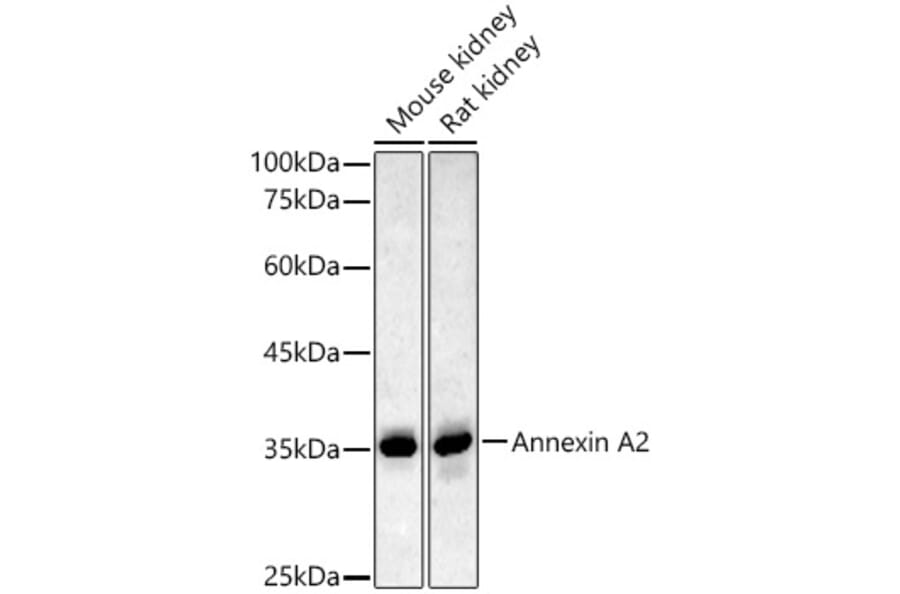Western Blot - Anti-Annexin A2 Antibody (A13514) - Antibodies.com