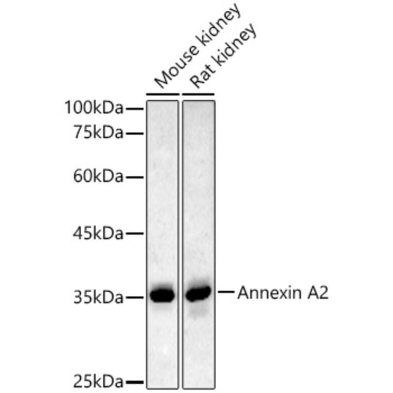 Western Blot - Anti-Annexin A2 Antibody (A13514) - Antibodies.com