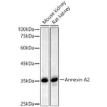 Western Blot - Anti-Annexin A2 Antibody (A13514) - Antibodies.com
