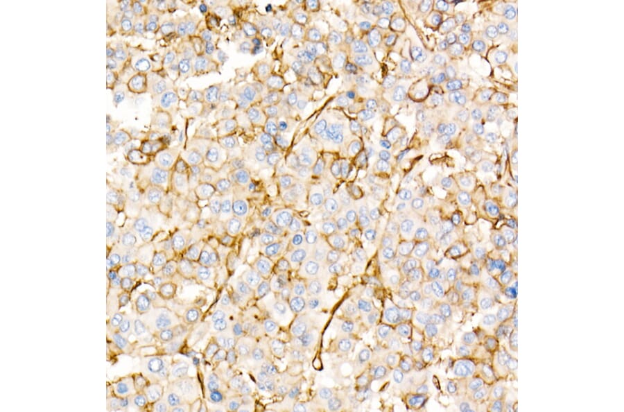 Immunohistochemistry - Anti-Annexin A2 Antibody (A13514) - Antibodies.com