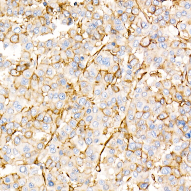 Immunohistochemistry - Anti-Annexin A2 Antibody (A13514) - Antibodies.com