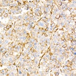 Immunohistochemistry - Anti-Annexin A2 Antibody (A13514) - Antibodies.com