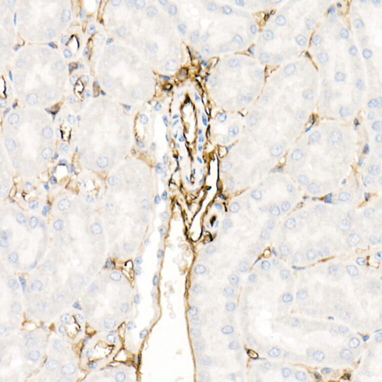 Immunohistochemistry - Anti-Annexin A2 Antibody (A13514) - Antibodies.com