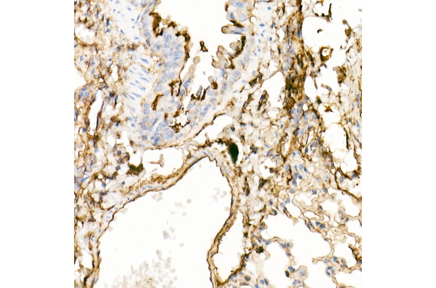 Immunohistochemistry - Anti-Annexin A2 Antibody (A13514) - Antibodies.com