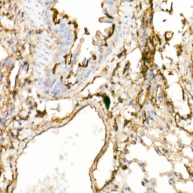 Immunohistochemistry - Anti-Annexin A2 Antibody (A13514) - Antibodies.com